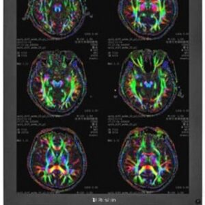 Монитор RESHIN MD32C, [RESHIN-MD32C-RU]